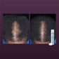 Women's Rogaine 5% Minoxidil Foam for Hair Thinning and Loss, Topical Treatment for Hair Regrowth 2.11oz - New