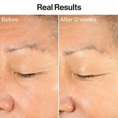 Honest Beauty Ageless Firm and Even Serum 1.0 fl oz - Imperfect Box