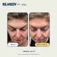 Remedy Skin Healthy Aging Serum 1 fl oz - Imperfect Box